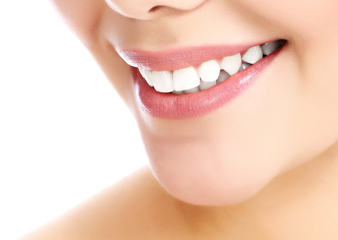 White teeth Smiling Woman